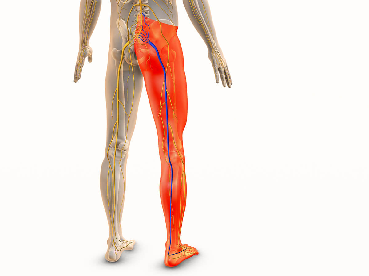 8-Tips-for-Managing-Sciatica-with-Massage-Therapy